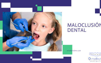Maloclusión dental
