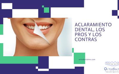 Aclaramiento dental, los pros y los contras