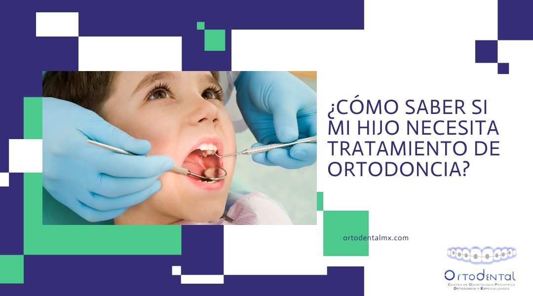 ¿Cómo saber si mi hijo necesita tratamiento de ortodoncia?