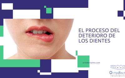El proceso del deterioro de los dientes