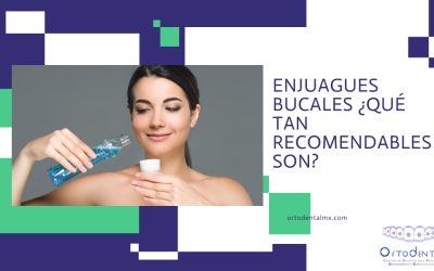Enjuagues bucales ¿Qué tan recomendables son?