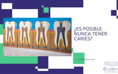 ¿Es posible nunca tener caries?