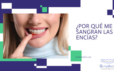 ¿Por qué me sangran las encías?