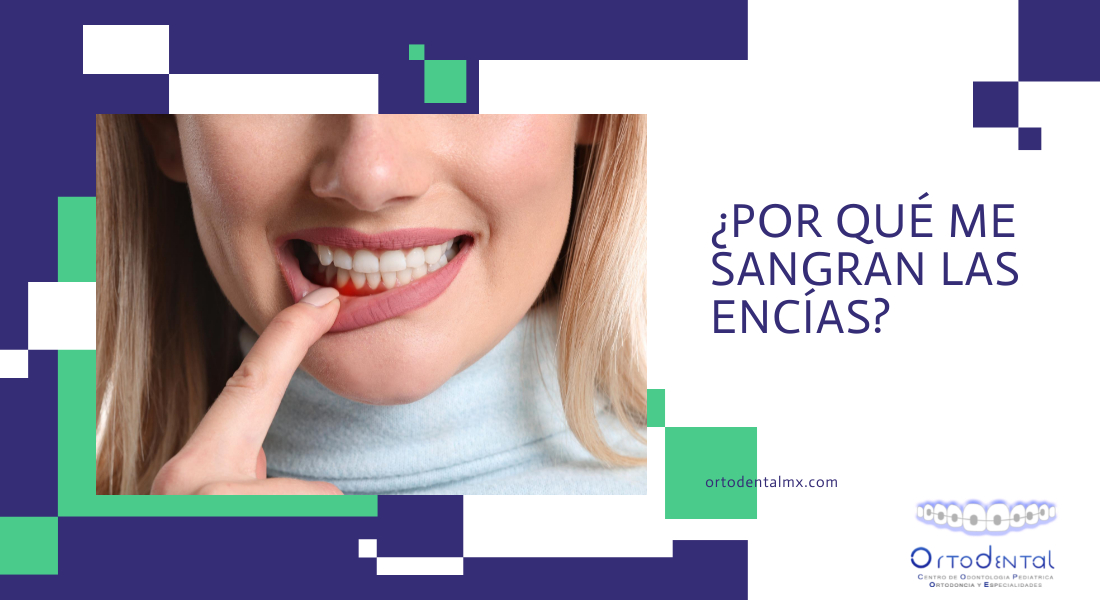 ¿Por qué me sangran las encías? - Ortodental