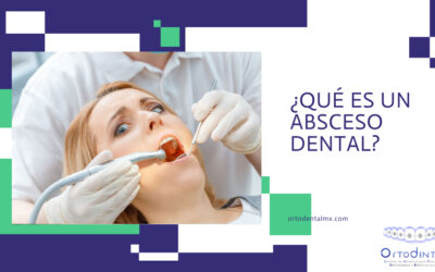 ¿Qué es un absceso dental?