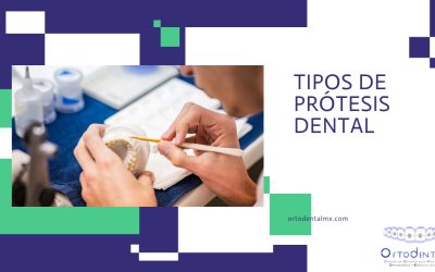 Tipos de Prótesis Dental