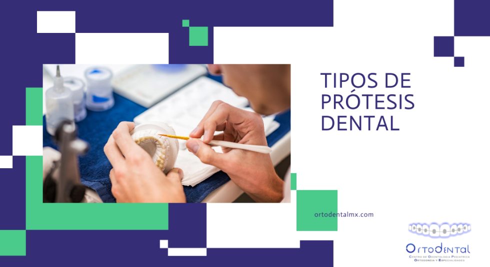 Tipos De Prótesis Dental - Ortodental