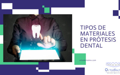 Tipos de materiales en Prótesis Dental