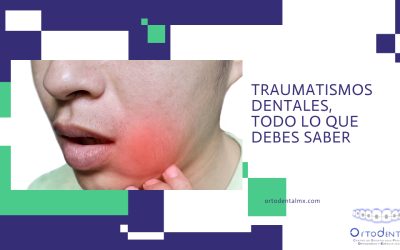 Traumatismos dentales, todo lo que debes saber