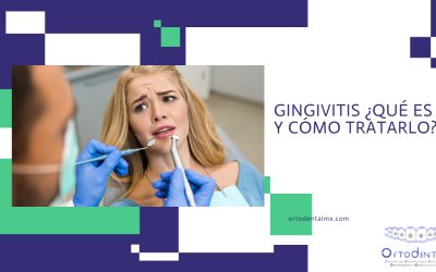 Gingivitis ¿Qué es y cómo tratarlo?