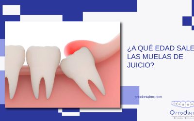 ¿A qué edad salen las muelas de juicio?