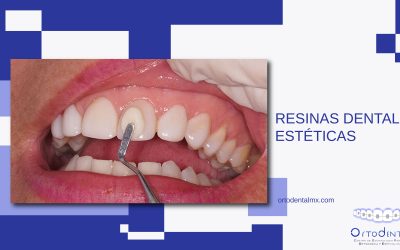 Resinas dentales estéticas