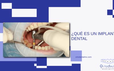 ¿Qué es un implante dental?
