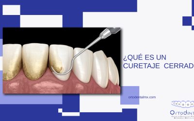 ¿Qué es un curetaje cerrado?