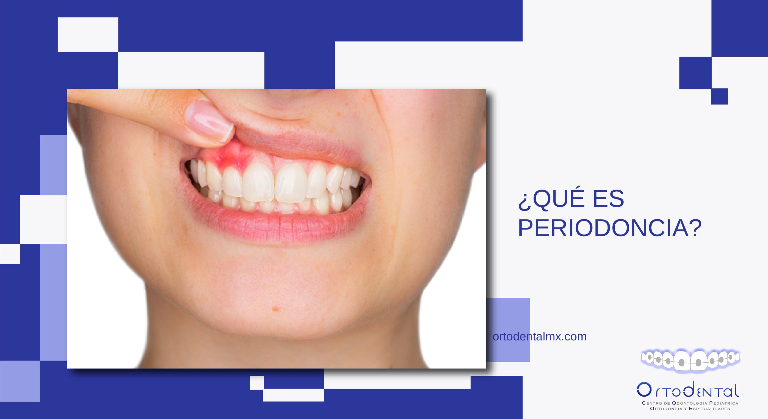 ¿qué Es Periodoncia Ortodentalemk 0901