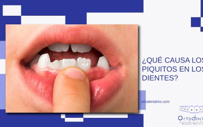 ¿Qué causa los piquitos en los dientes?