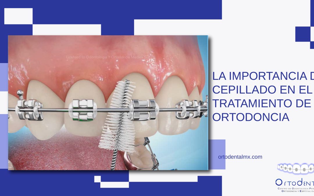 La importancia del cepillado en el tratamiento de ortodoncia