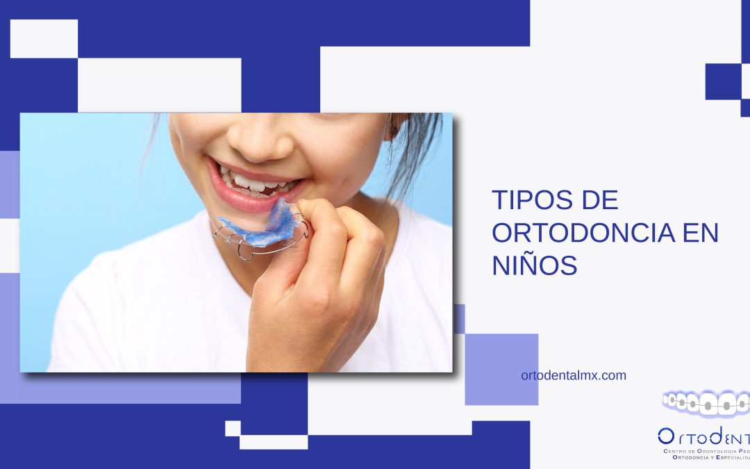 Tipos de ortodoncia en niños