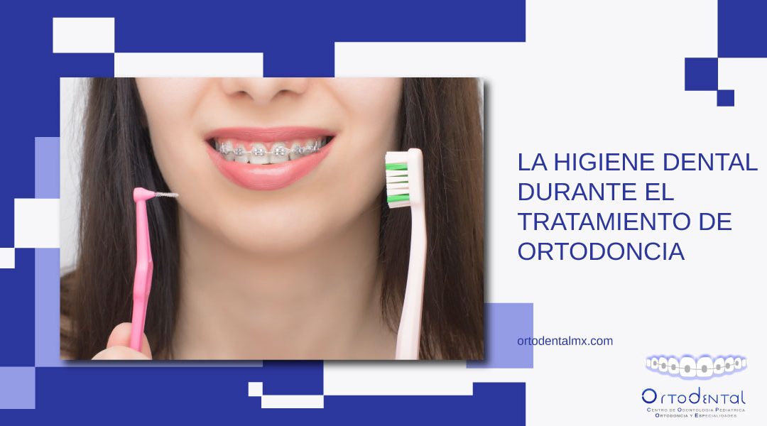 La higiene dental durante el tratamiento de ortodoncia