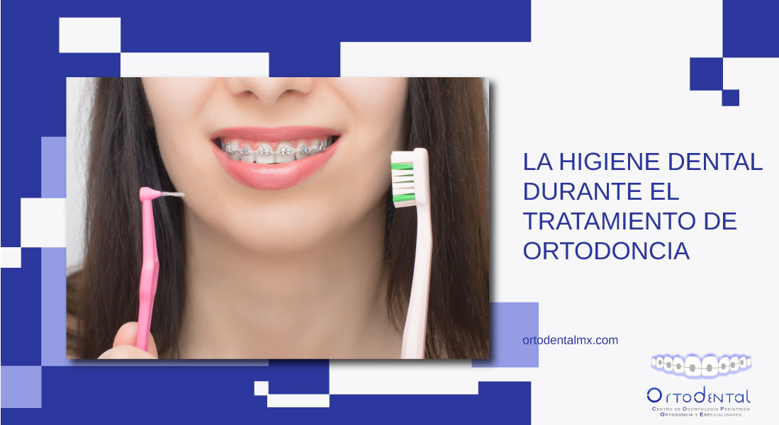 La Higiene Dental Durante Un Tratamiento De Ortodoncia - Ortodental