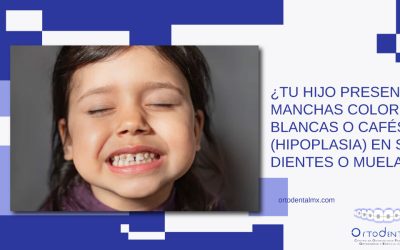 ¿Tu hijo presenta manchas color blancas o cafés (hipoplasia) en sus dientes o muelas?