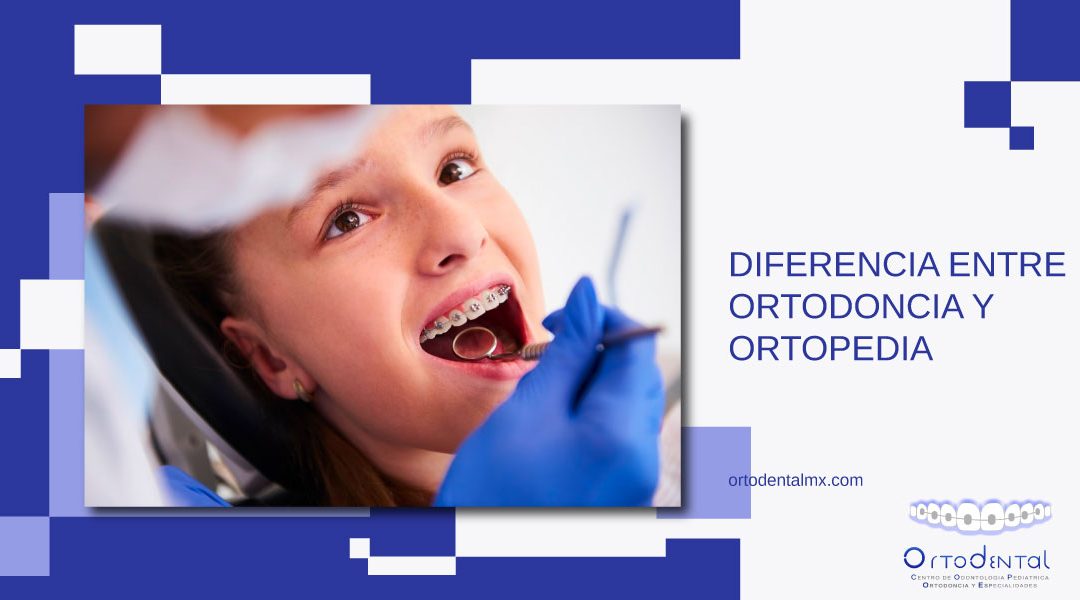 Diferencia entre ortodoncia y ortopedia